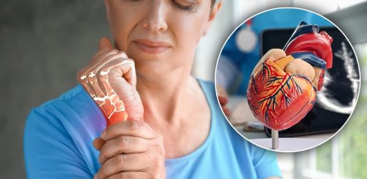 Bolest koja uništava zglobove i srce: Prepoznajte opasnu reumatsku groznicu na vreme Bolest koja uništava zglobove i srce: Prepoznajte opasnu reumatsku groznicu na vreme - featured image