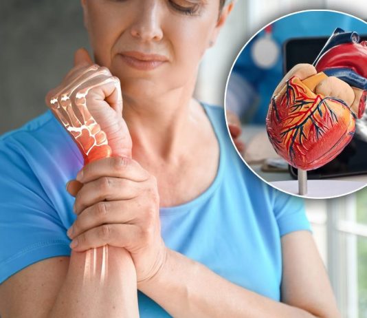 Bolest koja uništava zglobove i srce: Prepoznajte opasnu reumatsku groznicu na vreme Bolest koja uništava zglobove i srce: Prepoznajte opasnu reumatsku groznicu na vreme - featured image