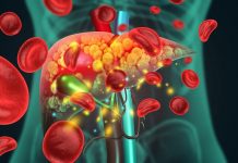 Akutno otkazivanje jetre: 9 simptoma koje ne smete ignorisati – opasno je po život Akutno otkazivanje jetre: 9 simptoma koje ne smete ignorisati – opasno je po život - featured image