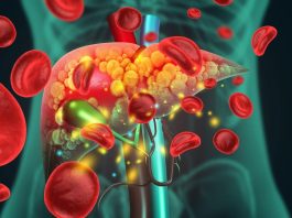 Akutno otkazivanje jetre: 9 simptoma koje ne smete ignorisati – opasno je po život Akutno otkazivanje jetre: 9 simptoma koje ne smete ignorisati – opasno je po život - featured image