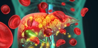 Akutno otkazivanje jetre: 9 simptoma koje ne smete ignorisati – opasno je po život Akutno otkazivanje jetre: 9 simptoma koje ne smete ignorisati – opasno je po život - featured image