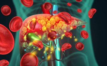 Akutno otkazivanje jetre: 9 simptoma koje ne smete ignorisati – opasno je po život Akutno otkazivanje jetre: 9 simptoma koje ne smete ignorisati – opasno je po život - featured image