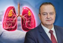 Simptomi obostrane upale pluća zbog koje je Ivica Dačić na respiratoru: Što je više režnjeva zahvaćeno, komplikacije su veće Simptomi obostrane upale pluća zbog koje je Ivica Dačić na respiratoru: Što je više režnjeva zahvaćeno, komplikacije su veće - featured image