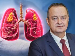 Simptomi obostrane upale pluća zbog koje je Ivica Dačić na respiratoru: Što je više režnjeva zahvaćeno, komplikacije su veće Simptomi obostrane upale pluća zbog koje je Ivica Dačić na respiratoru: Što je više režnjeva zahvaćeno, komplikacije su veće - featured image
