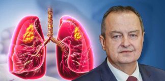 Simptomi obostrane upale pluća zbog koje je Ivica Dačić na respiratoru: Što je više režnjeva zahvaćeno, komplikacije su veće Simptomi obostrane upale pluća zbog koje je Ivica Dačić na respiratoru: Što je više režnjeva zahvaćeno, komplikacije su veće - featured image