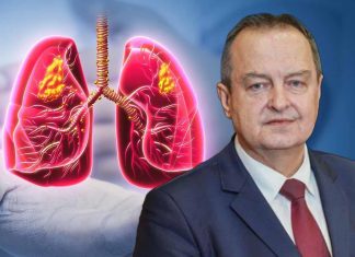 Simptomi obostrane upale pluća zbog koje je Ivica Dačić na respiratoru: Što je više režnjeva zahvaćeno, komplikacije su veće Simptomi obostrane upale pluća zbog koje je Ivica Dačić na respiratoru: Što je više režnjeva zahvaćeno, komplikacije su veće - featured image