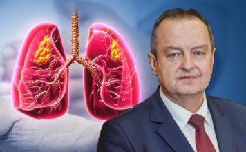 Simptomi obostrane upale pluća zbog koje je Ivica Dačić na respiratoru: Što je više režnjeva zahvaćeno, komplikacije su veće Simptomi obostrane upale pluća zbog koje je Ivica Dačić na respiratoru: Što je više režnjeva zahvaćeno, komplikacije su veće - featured image