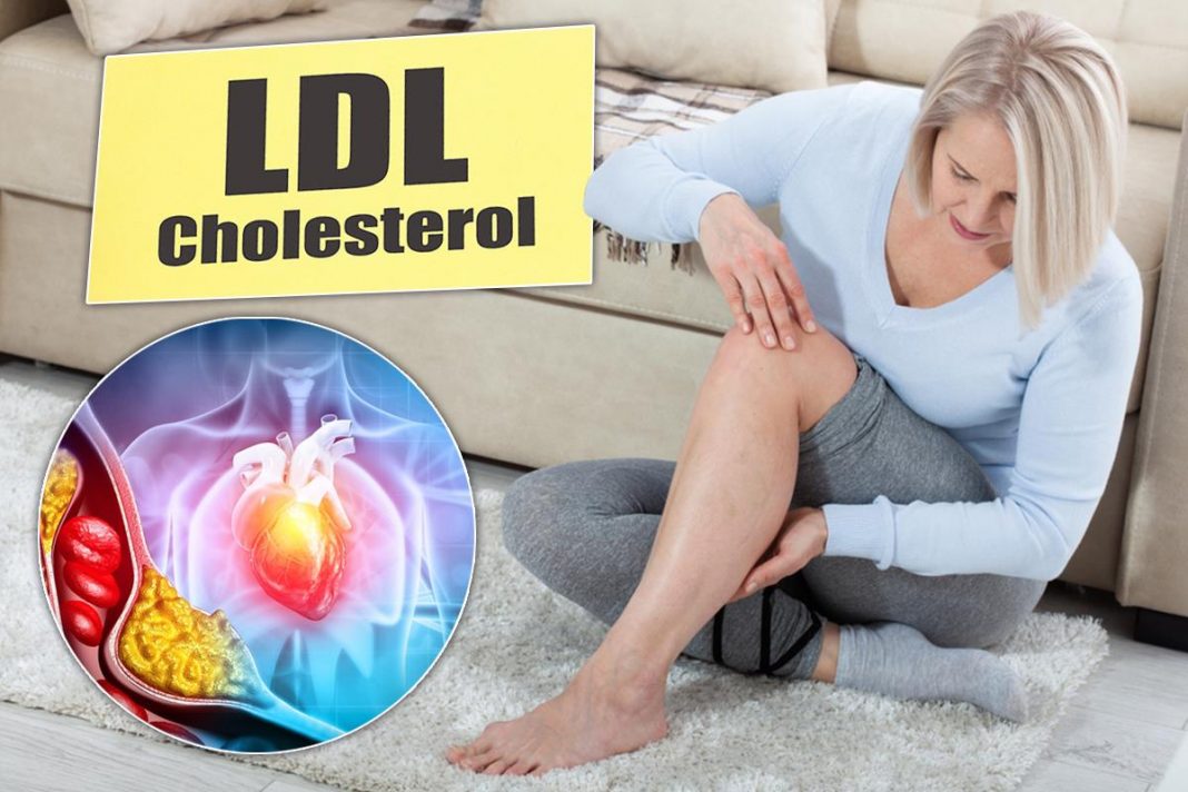 Tihi signali povišenog holesterola: 6 znakova na nogama koje ne smete ignorisati - featured image