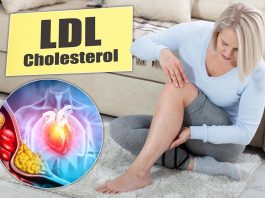 Tihi signali povišenog holesterola: 6 znakova na nogama koje ne smete ignorisati Tihi signali povišenog holesterola: 6 znakova na nogama koje ne smete ignorisati - featured image