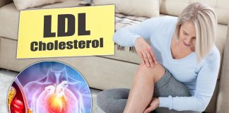 Tihi signali povišenog holesterola: 6 znakova na nogama koje ne smete ignorisati Tihi signali povišenog holesterola: 6 znakova na nogama koje ne smete ignorisati - featured image