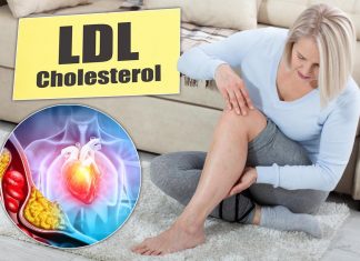 Tihi signali povišenog holesterola: 6 znakova na nogama koje ne smete ignorisati Tihi signali povišenog holesterola: 6 znakova na nogama koje ne smete ignorisati - featured image