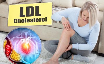 Tihi signali povišenog holesterola: 6 znakova na nogama koje ne smete ignorisati Tihi signali povišenog holesterola: 6 znakova na nogama koje ne smete ignorisati - featured image