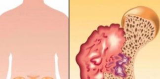 Ako osjetite bolove u kostima, visoki krvni tlak i osjećaj tuge, to može ukazivati na nedostatak ovog ključnog vitamina Ako osjetite bolove u kostima, visoki krvni tlak i osjećaj tuge, to može ukazivati na nedostatak ovog ključnog vitamina - featured image