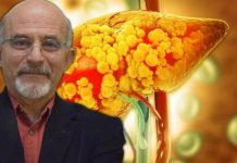 Jetra najviše strada zbog ovih navika: Prof. dr Stojiljković otkriva šta odmah da izbacite