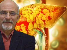 Jetra najviše strada zbog ovih navika: Prof. dr Stojiljković otkriva šta odmah da izbacite