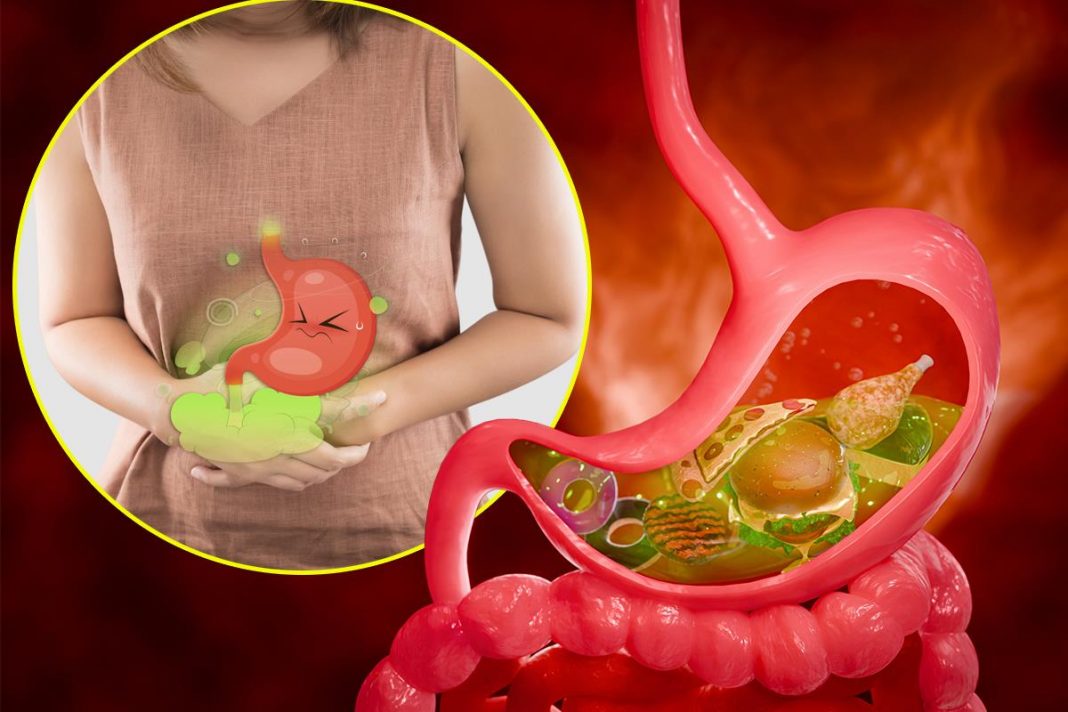 10 namirnica koje izazivaju gasove i nadutost: Pasulj jeste glavni, ali ne i jedini krivac - featured image