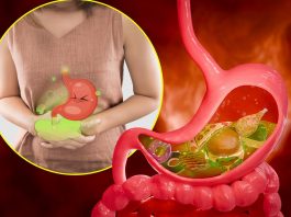 10 namirnica koje izazivaju gasove i nadutost: Pasulj jeste glavni, ali ne i jedini krivac 10 namirnica koje izazivaju gasove i nadutost: Pasulj jeste glavni, ali ne i jedini krivac - featured image