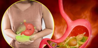 10 namirnica koje izazivaju gasove i nadutost: Pasulj jeste glavni, ali ne i jedini krivac 10 namirnica koje izazivaju gasove i nadutost: Pasulj jeste glavni, ali ne i jedini krivac - featured image