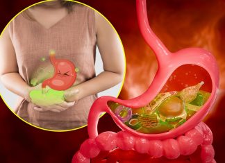 10 namirnica koje izazivaju gasove i nadutost: Pasulj jeste glavni, ali ne i jedini krivac 10 namirnica koje izazivaju gasove i nadutost: Pasulj jeste glavni, ali ne i jedini krivac - featured image