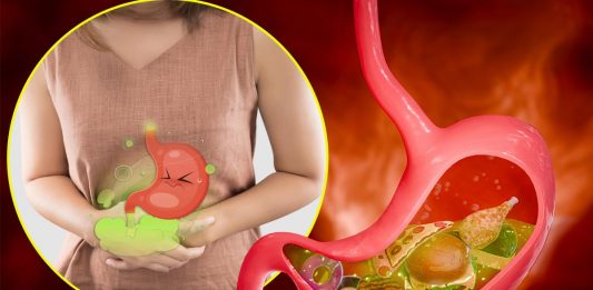 10 namirnica koje izazivaju gasove i nadutost: Pasulj jeste glavni, ali ne i jedini krivac 10 namirnica koje izazivaju gasove i nadutost: Pasulj jeste glavni, ali ne i jedini krivac - featured image