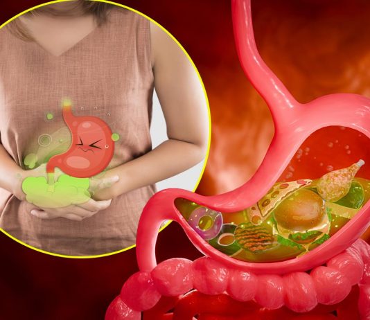 10 namirnica koje izazivaju gasove i nadutost: Pasulj jeste glavni, ali ne i jedini krivac 10 namirnica koje izazivaju gasove i nadutost: Pasulj jeste glavni, ali ne i jedini krivac - featured image