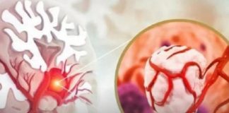 3 simptoma raka koji se javljaju ujutru: Upozoravaju na metastaze, a evo šta odmah treba uraditi