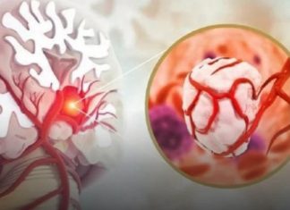 3 simptoma raka koji se javljaju ujutru: Upozoravaju na metastaze, a evo šta odmah treba uraditi